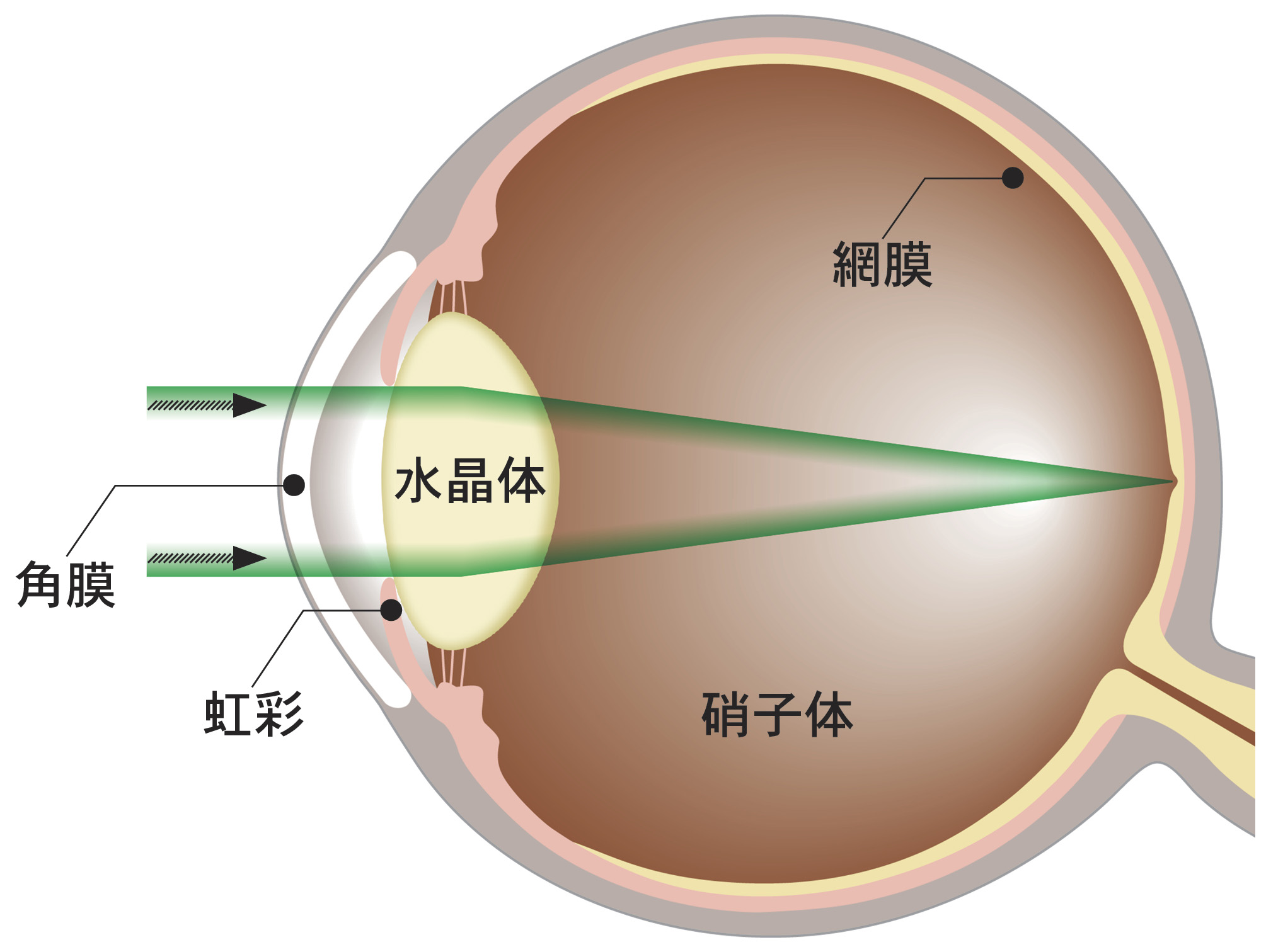 硝子体手術とは？